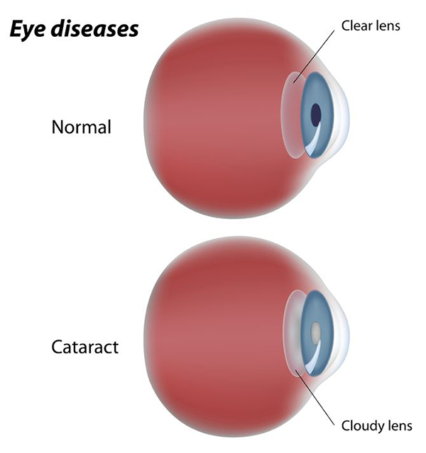 best optometrist in staten island